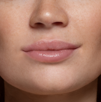 Zoes | Lip Butter Watermelon 15ml | Hydraterende Lipverzorging met SPF 8 &amp; High Shine